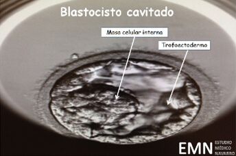Lee más sobre el artículo Conocer más sobre el cultivo secuencial hasta blastocisto